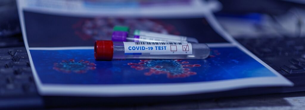 covid-19, coronavirus, quarantine, protection, disease, test, covid-19, covid-19, covid-19, covid-19, covid-19, coronavirus, coronavirus, coronavirus, quarantine, quarantine, test